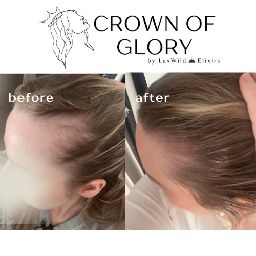 Crown of Glory - Regenerative Hair Growth Treatment
